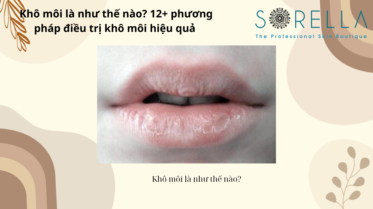 Khô môi là như thế nào?