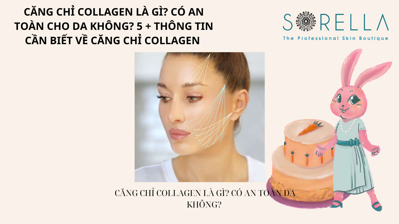 Căng chỉ collagen là gì?