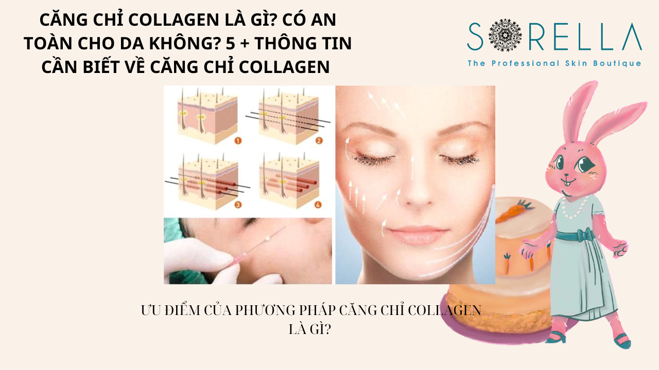 Căng chỉ collagen là gì?