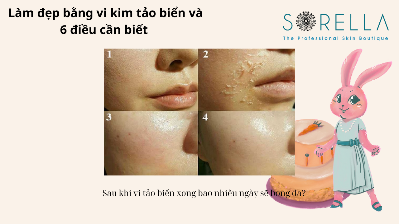 Làm đẹp bằng vi kim tảo biển 