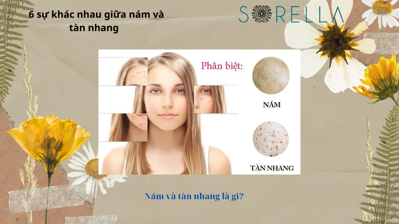 Sự khác nhau giữa nám và tàn nhang