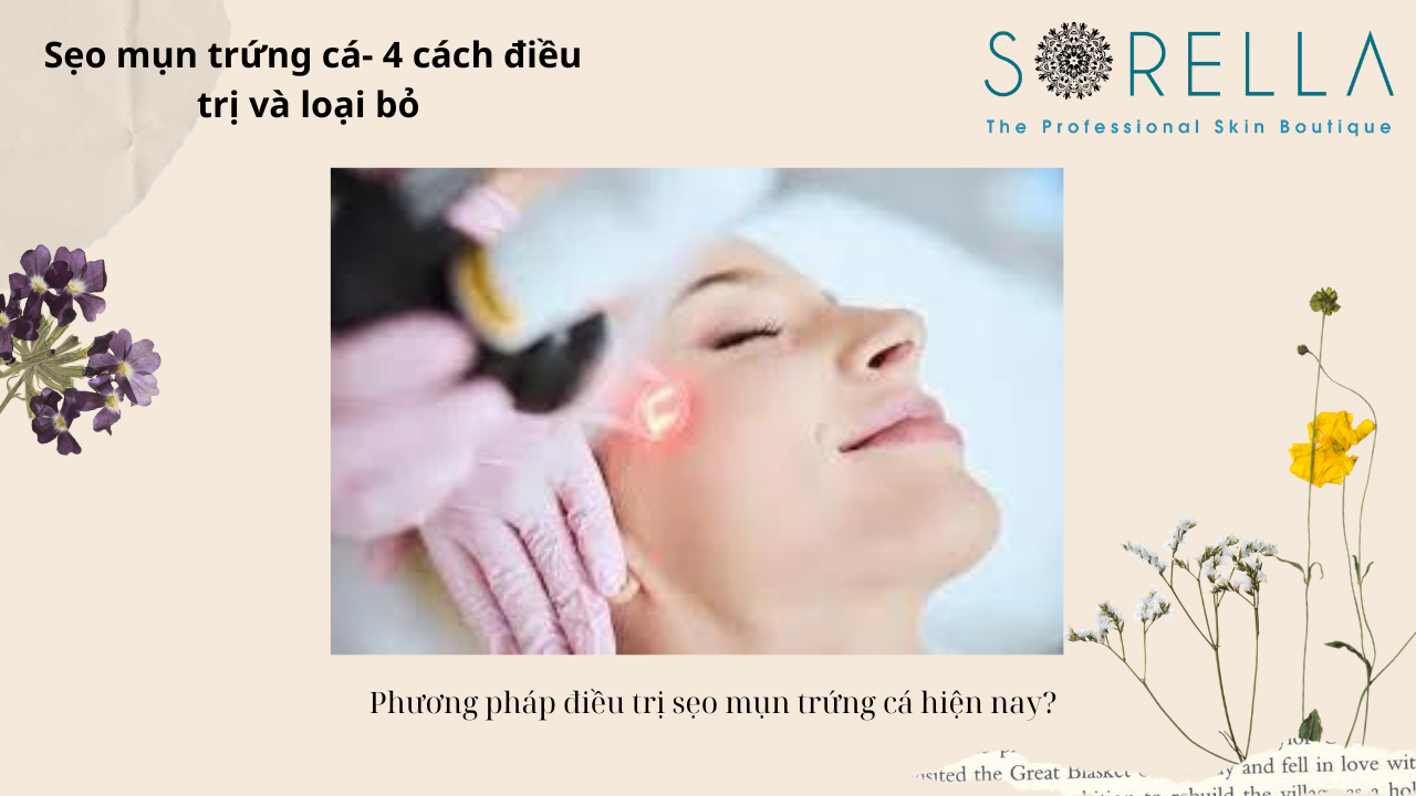 Sẹo mụn trứng cá