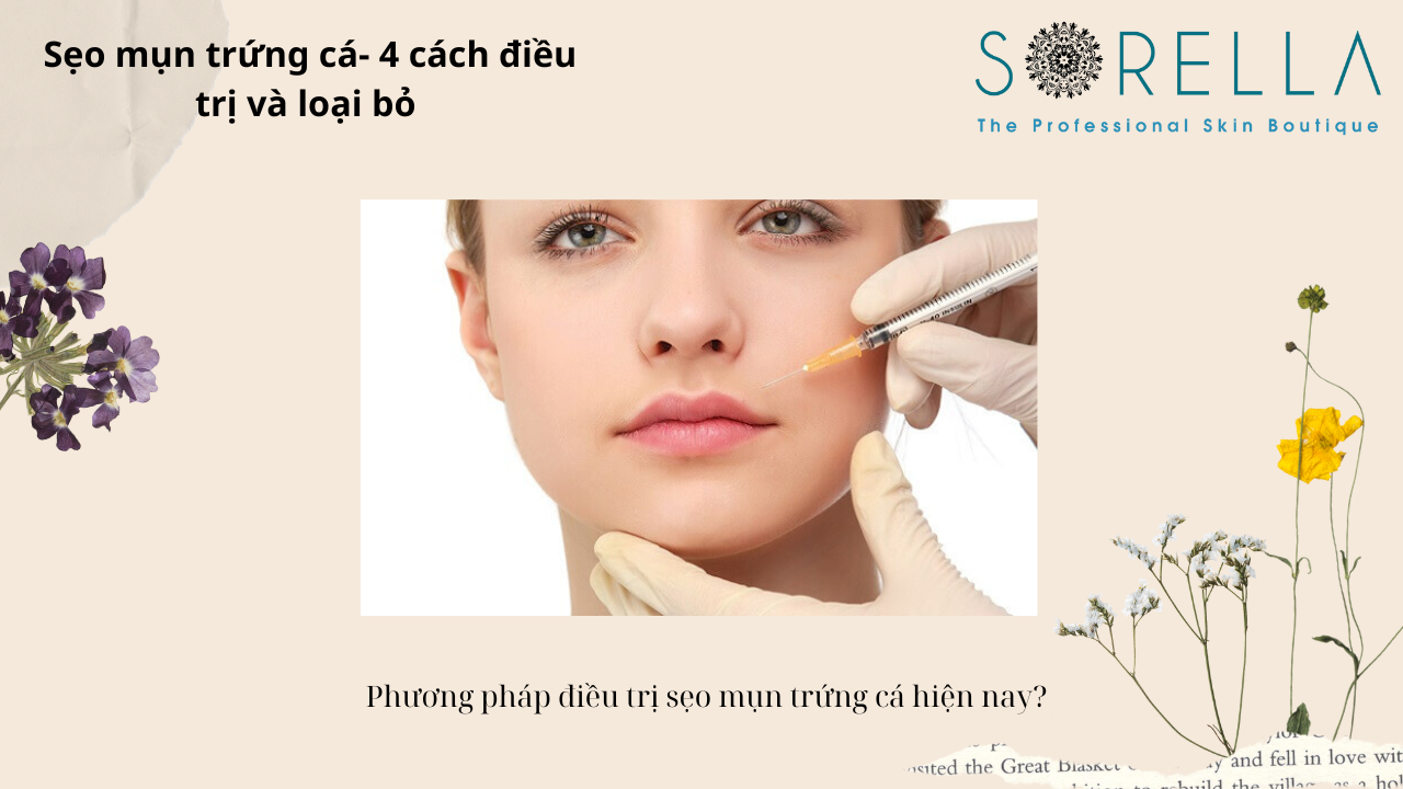 Sẹo mụn trứng cá