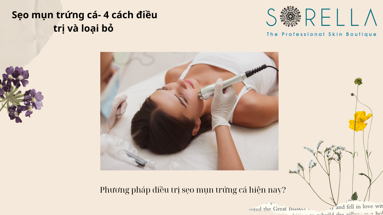 Sẹo mụn trứng cá