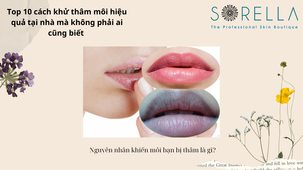 Top 10 cách khử thâm môi hiệu quả 
