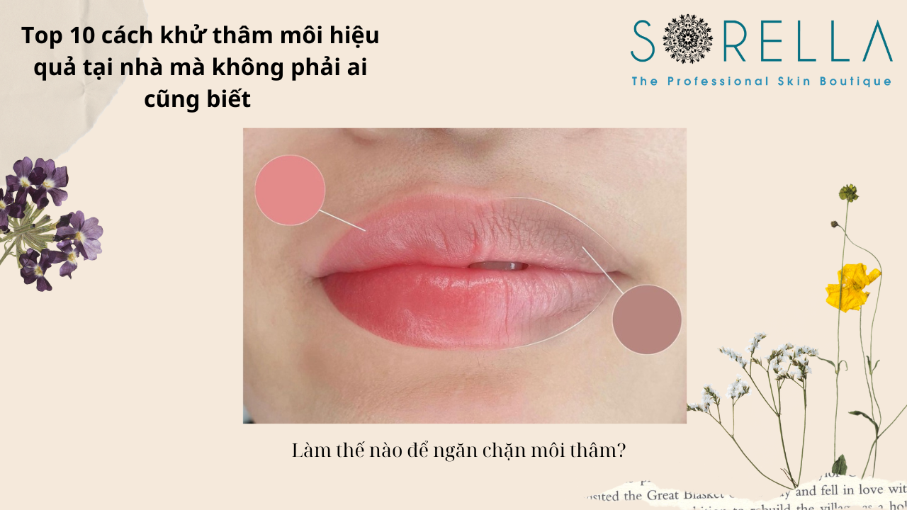 Top 10 cách khử thâm môi hiệu quả 