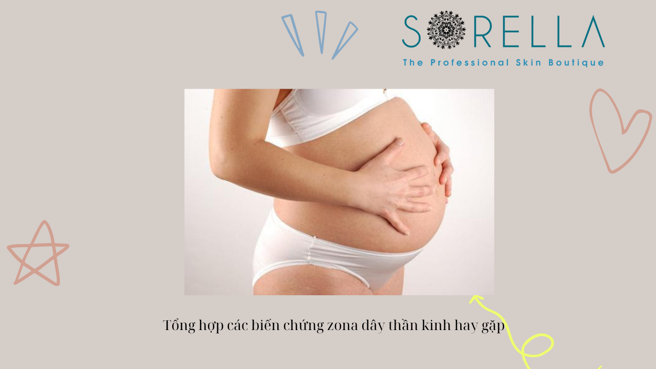 Biến chứng zona thần kinh