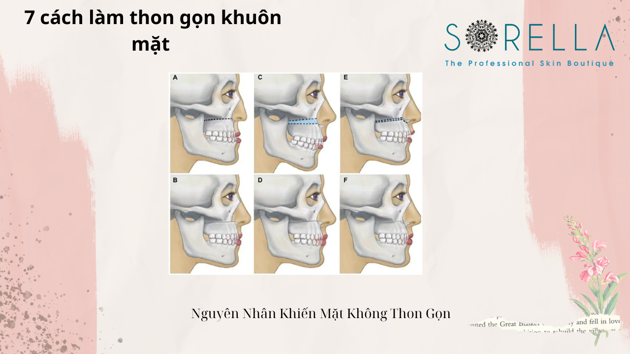 Cách làm thon gọn khuôn mặt