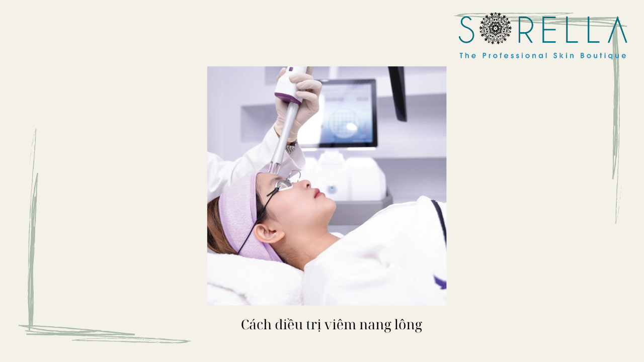 Viêm nang lông lả gì? 