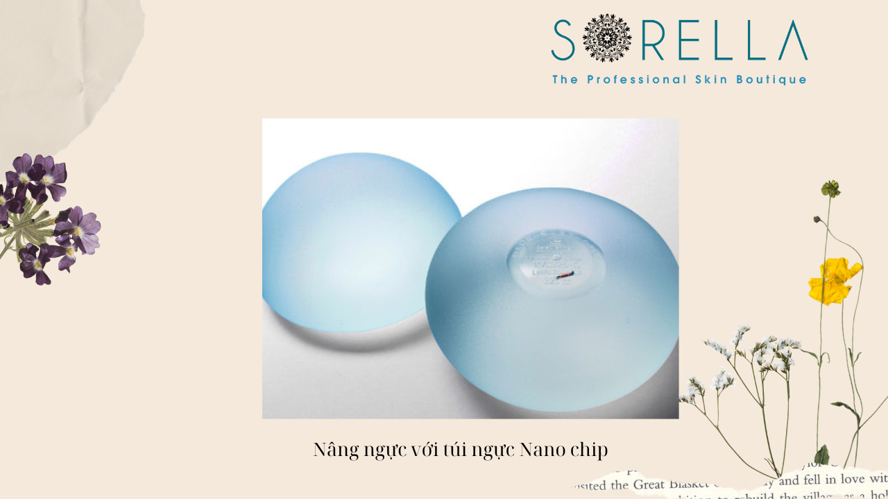 Nên nâng ngực Mentor hay Nano chip? 