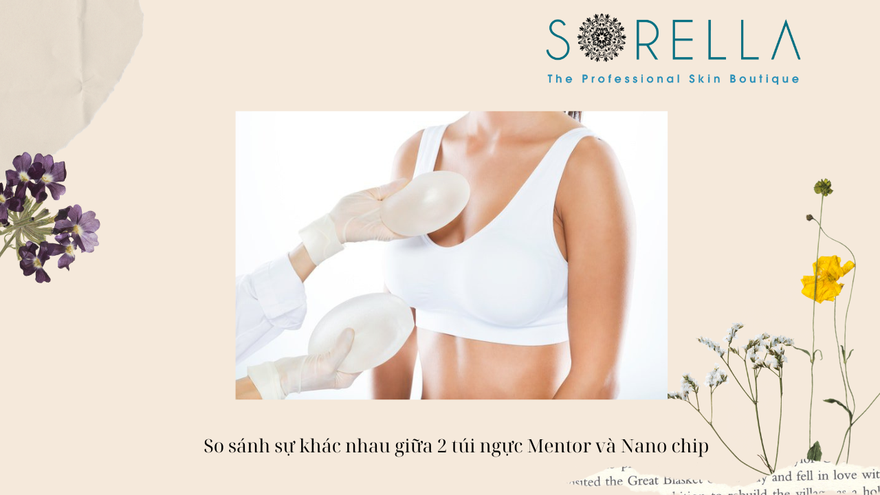 Nên nâng ngực Mentor hay Nano chip? 