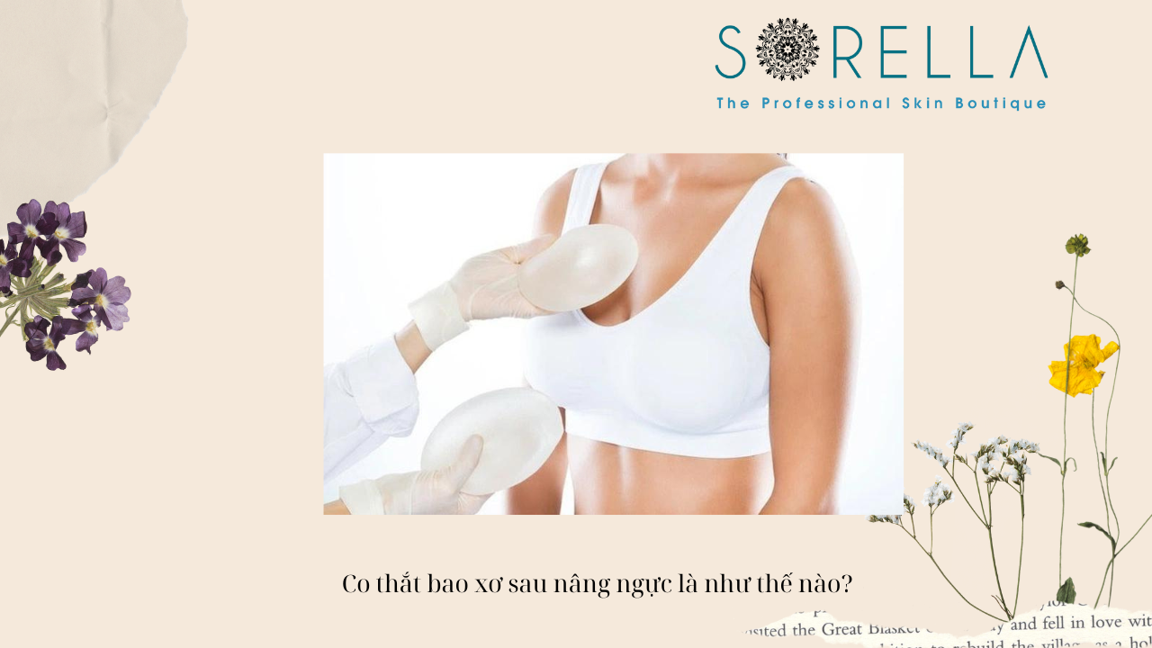 Co thắt bao xơ sau nâng ngực