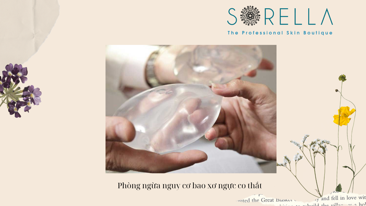 Co thắt bao xơ sau nâng ngực