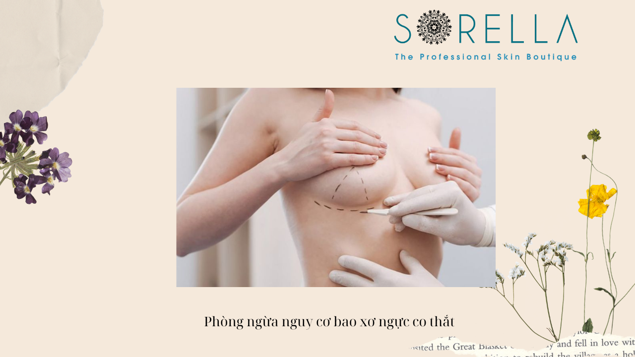 Co thắt bao xơ sau nâng ngực