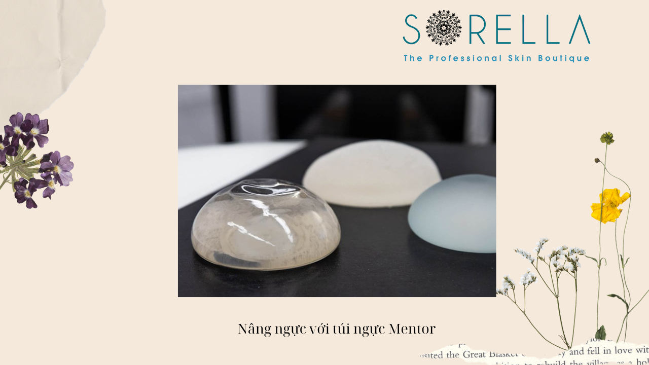 Nên nâng ngực Mentor hay Nano chip? 