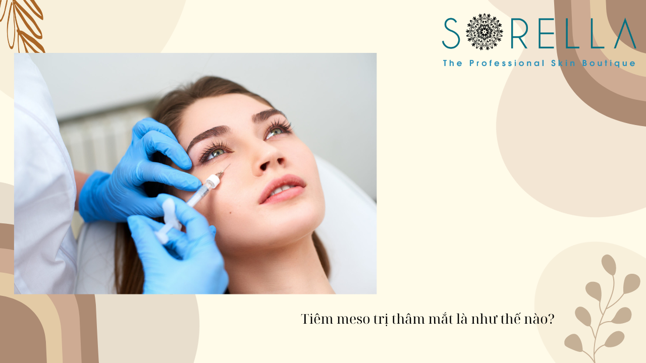 Tiêm meso trị thâm mắt là như thế nào?