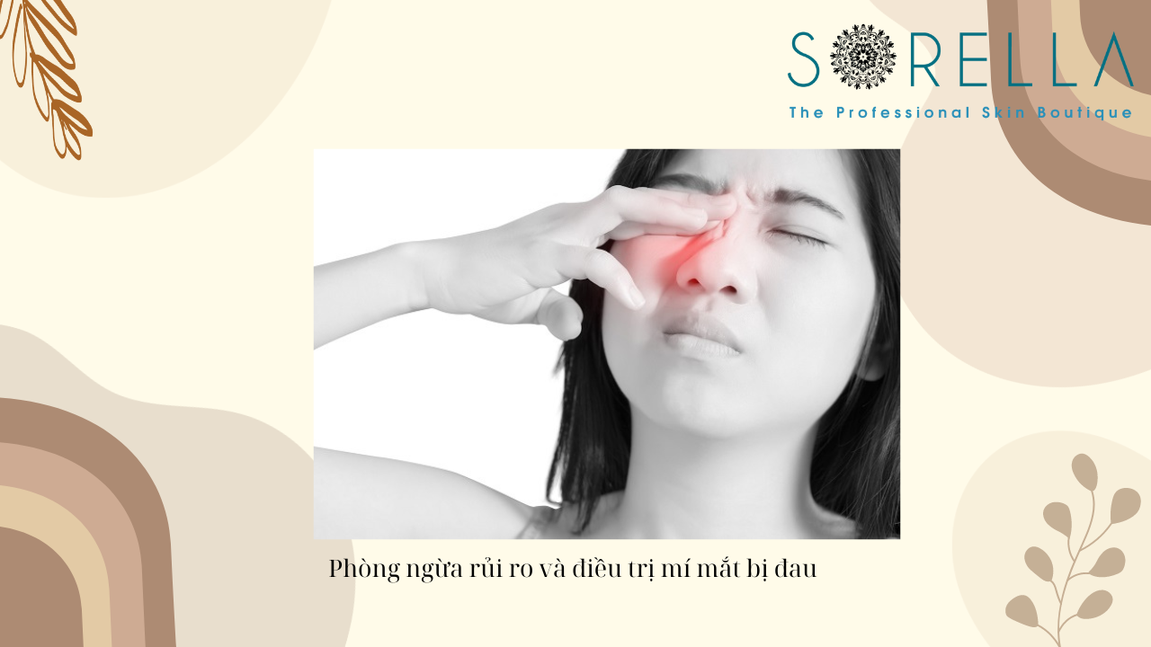 Đau khóe mắt là bị làm sao?