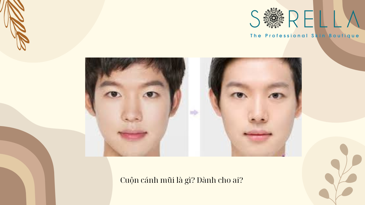 Cuộn cánh mũi là gì?