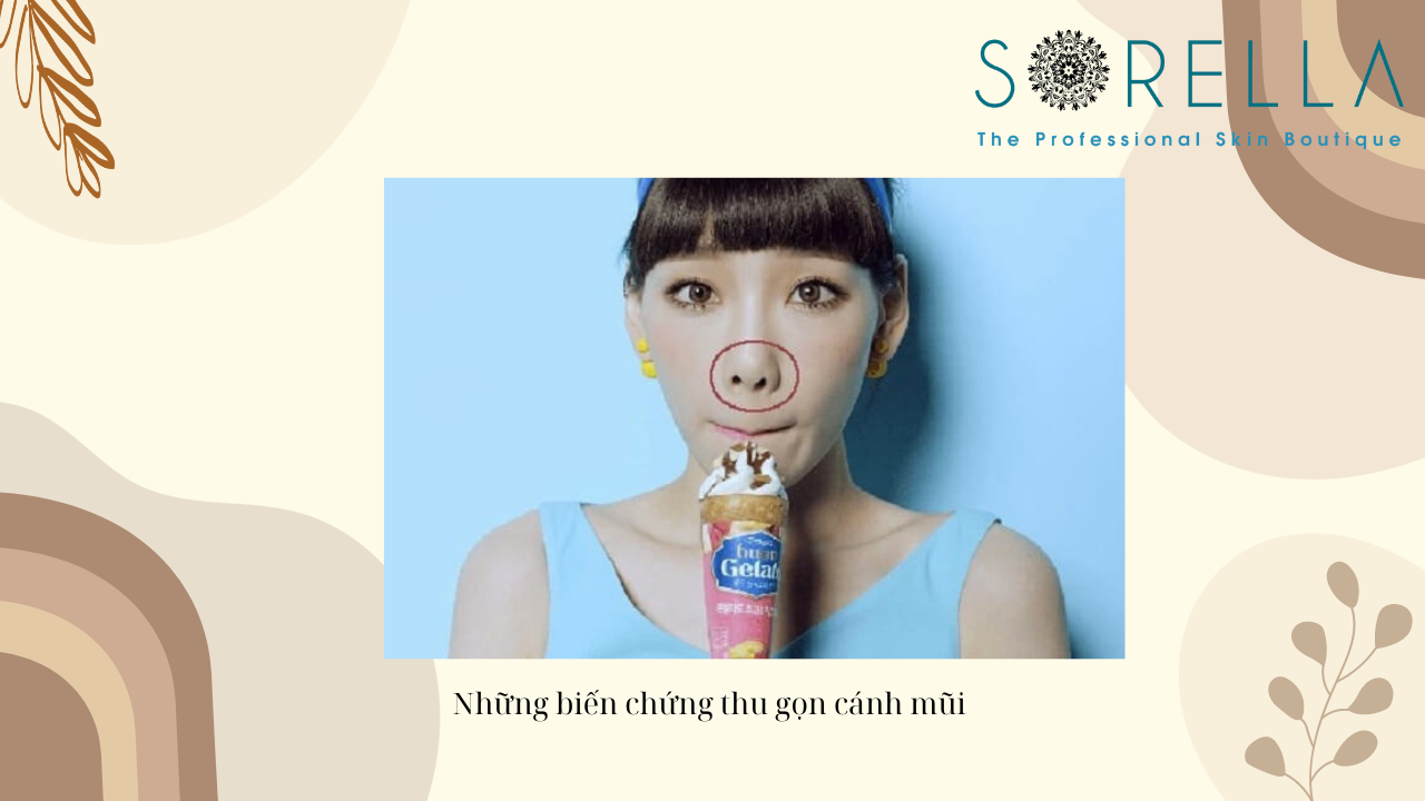 Cuộn cánh mũi là gì?