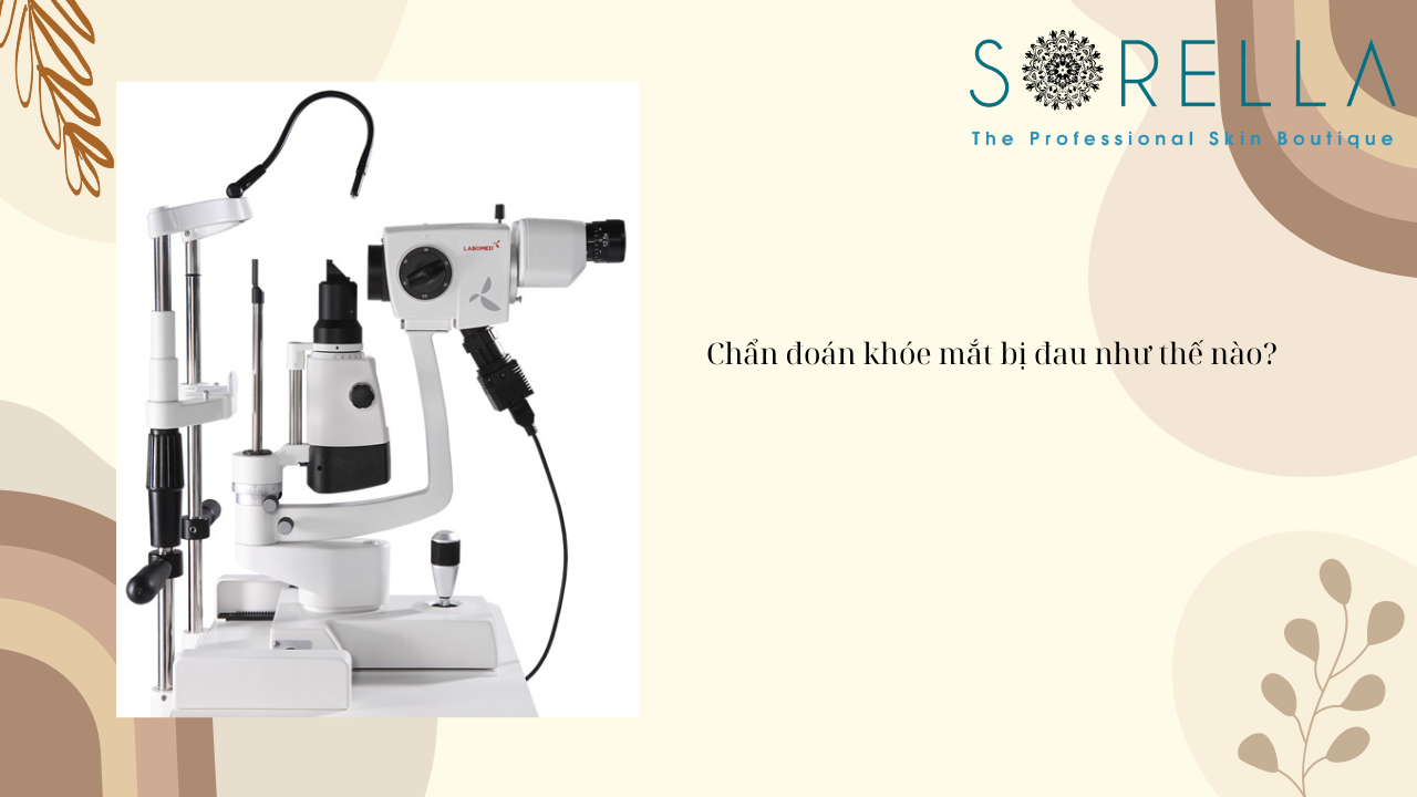 Đau khóe mắt là bị làm sao?