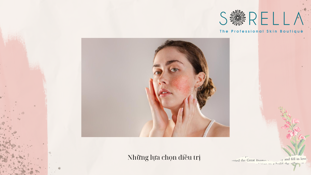 Có thể xoá bớt đen bẩm sinh không?
