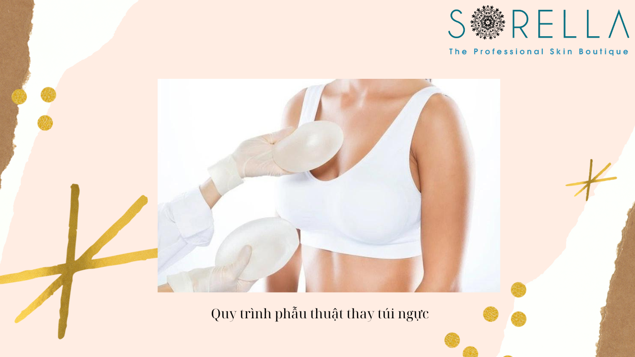 Dấu hiệu cần thay túi ngực 