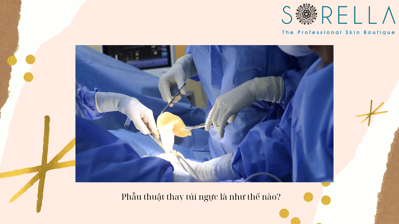 Dấu hiệu cần thay túi ngực 