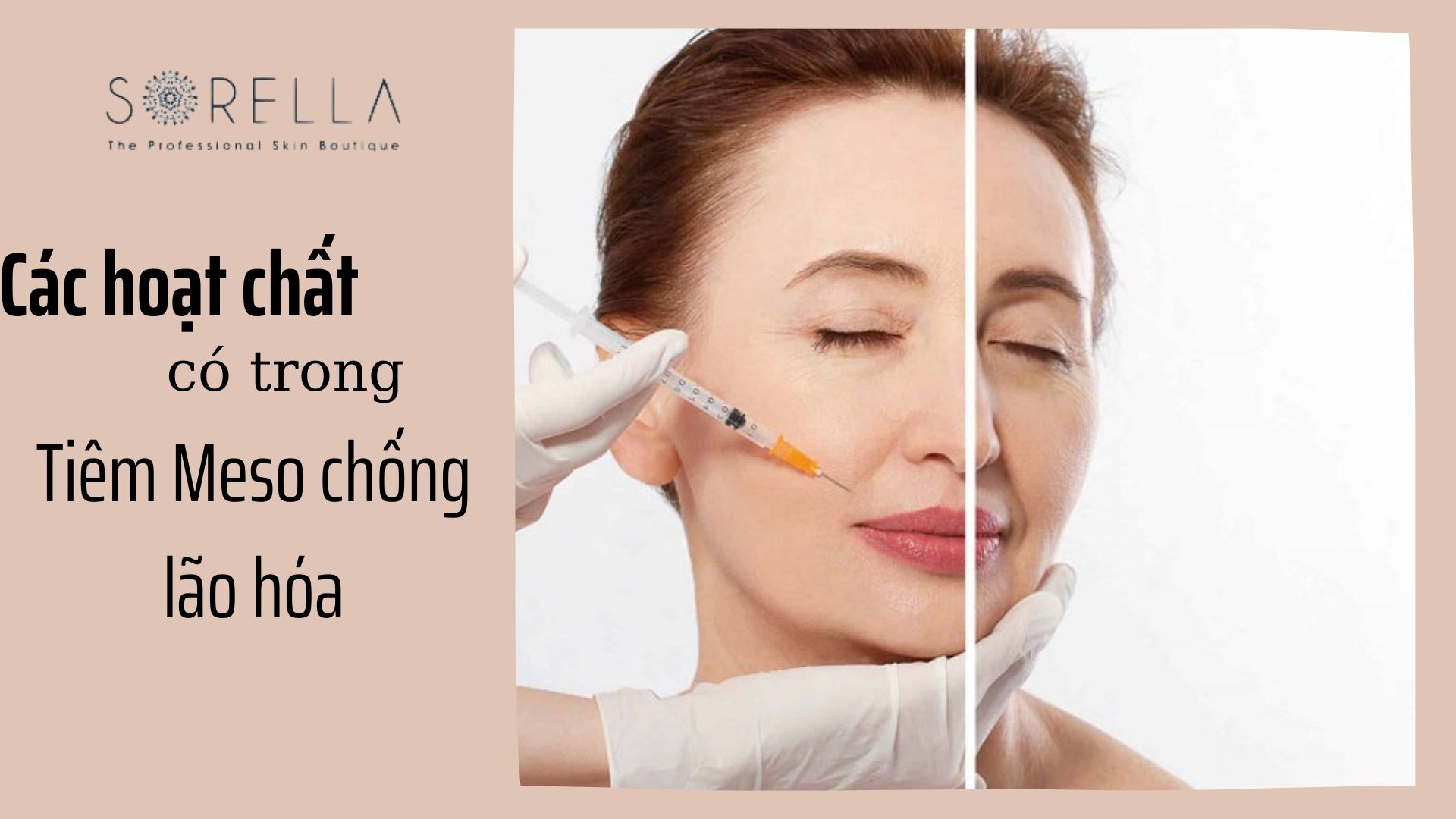 3 nhóm hoạt chất ứng dụng trong tiêm meso điều trị lão hóa, trắng da và sẹo lõm