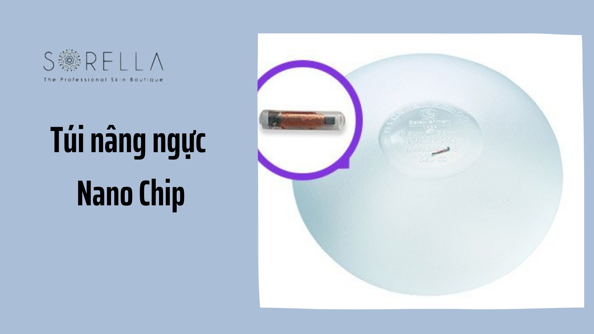 Top 3 loại túi nâng ngực tốt nhất hiện nay