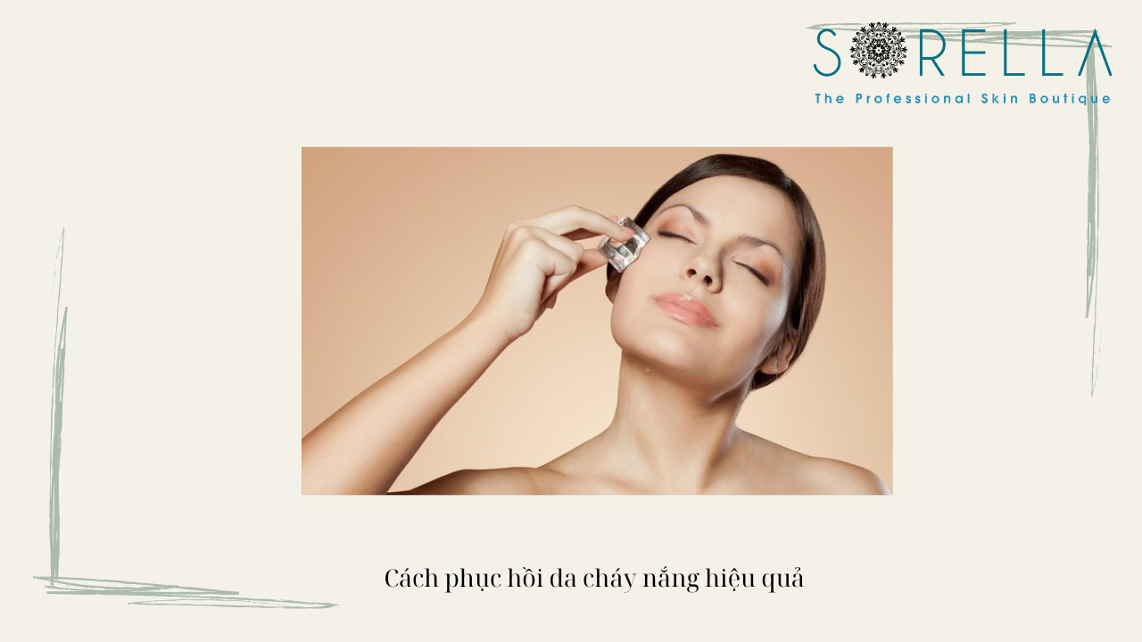 Bỏ túi ngay 5 tips phục hồi da cháy nắng 