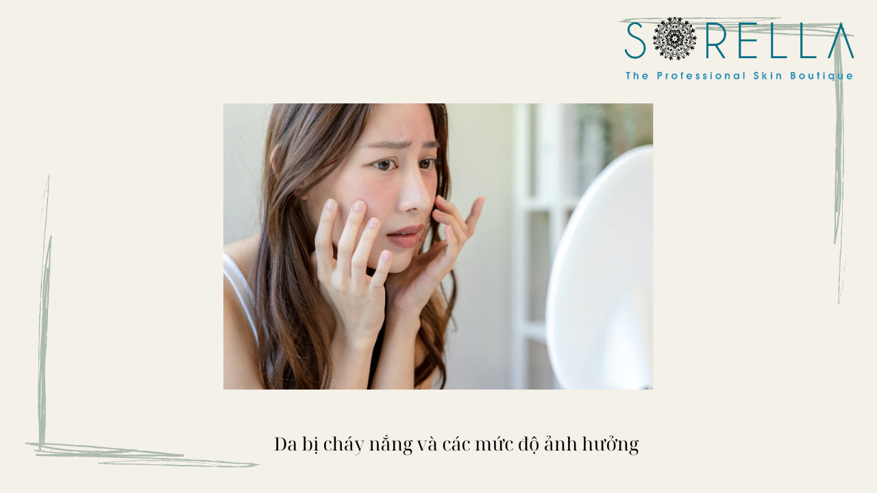 Mất bao lâu thì da cháy nắng phục hồi?