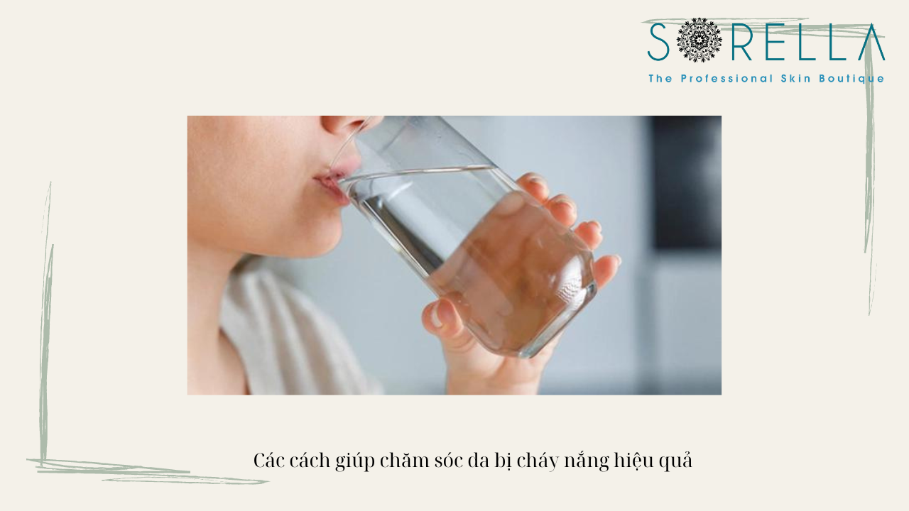 Chữa cháy nắng bằng thực phẩm