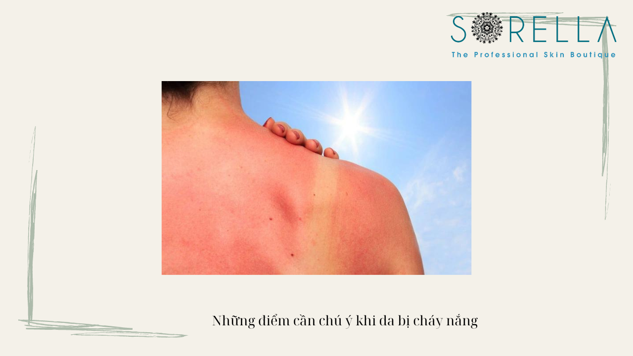 Mất bao lâu thì da cháy nắng phục hồi?