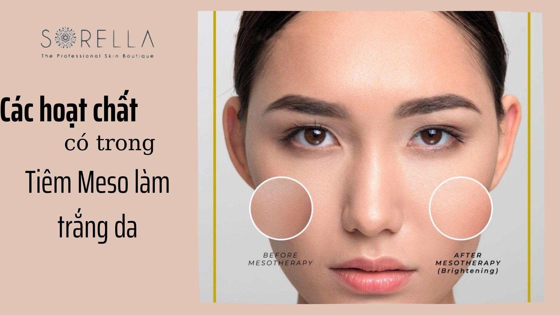 3 nhóm hoạt chất ứng dụng trong tiêm meso điều trị lão hóa, trắng da và sẹo lõm