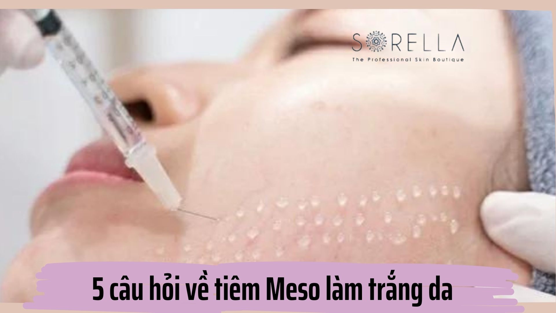 5 câu hỏi hay gặp khi tiêm Meso trắng da