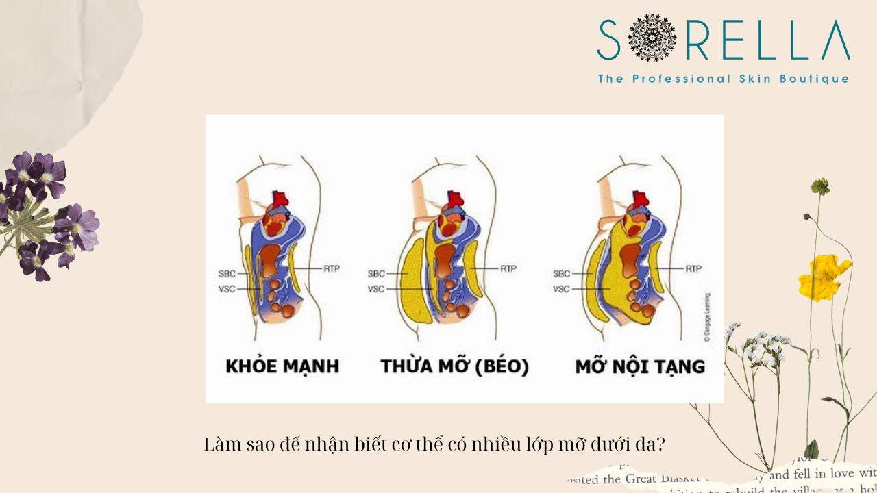 Lớp mỡ dưới da có vai trò như thế nào? 