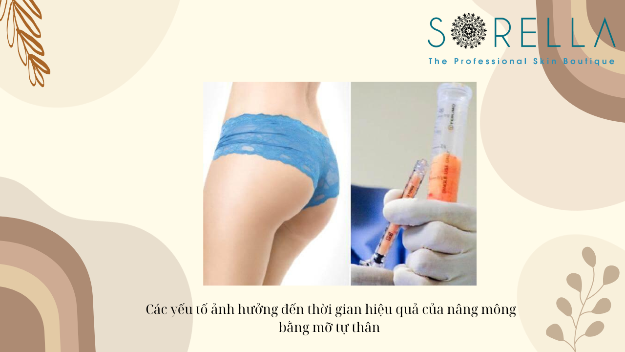 Nâng mông bằng mỡ tự thân là như thế nào? 