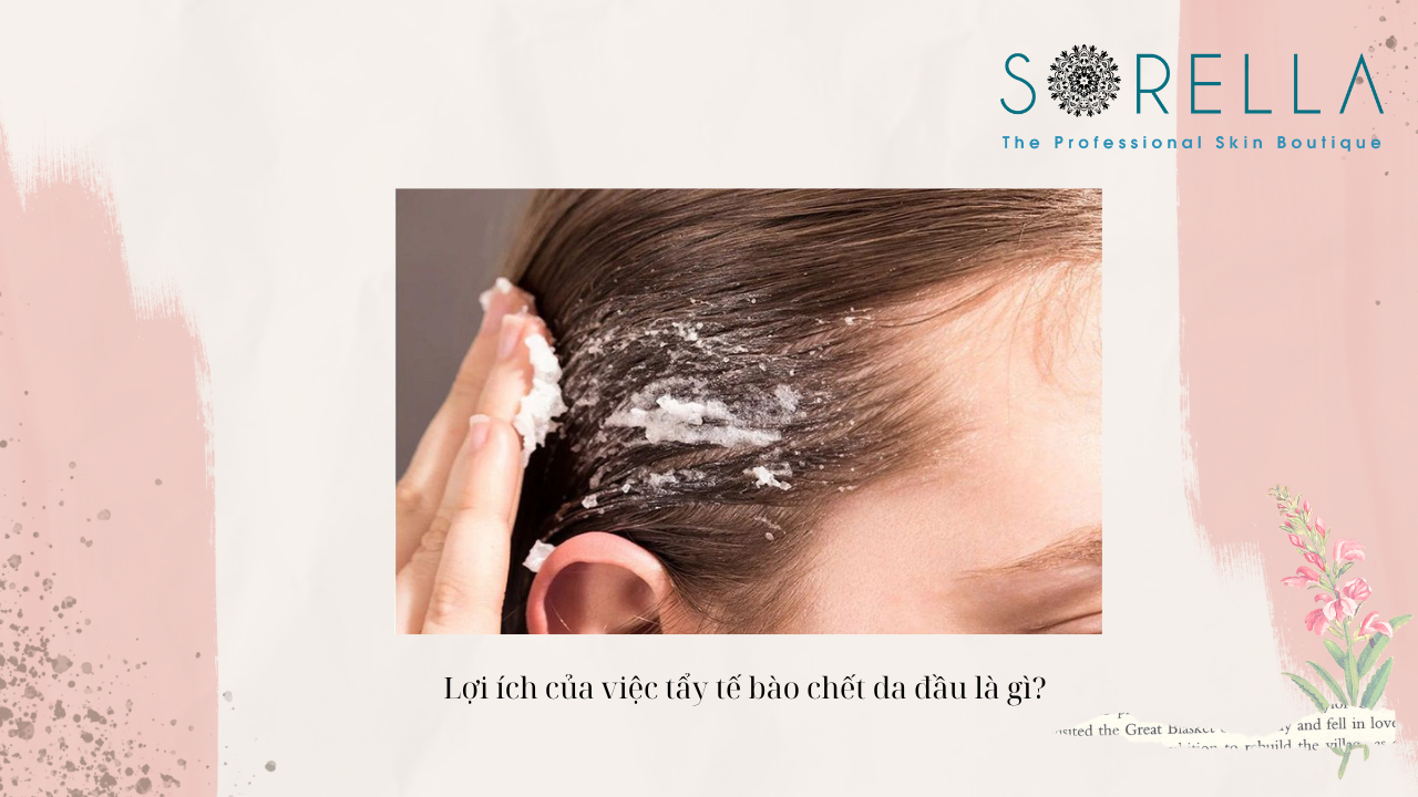 Có nên tẩy da chết trên da đầu?  
