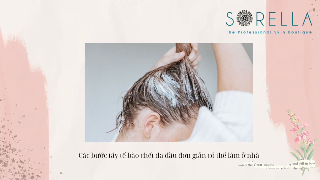 Có nên tẩy da chết trên da đầu?  