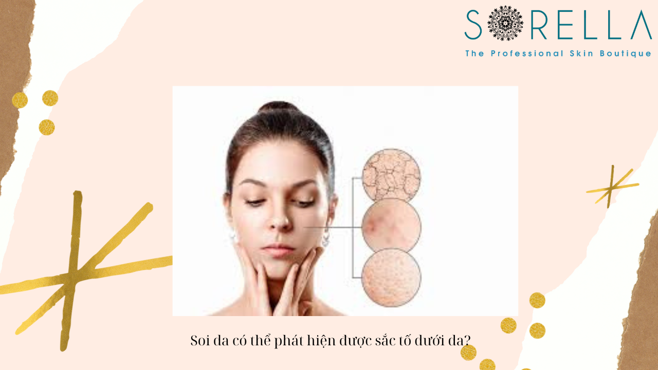 Soi da là gì?