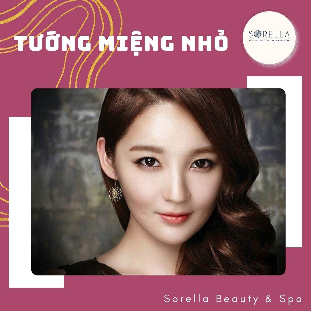 Tướng miệng nhỏ
