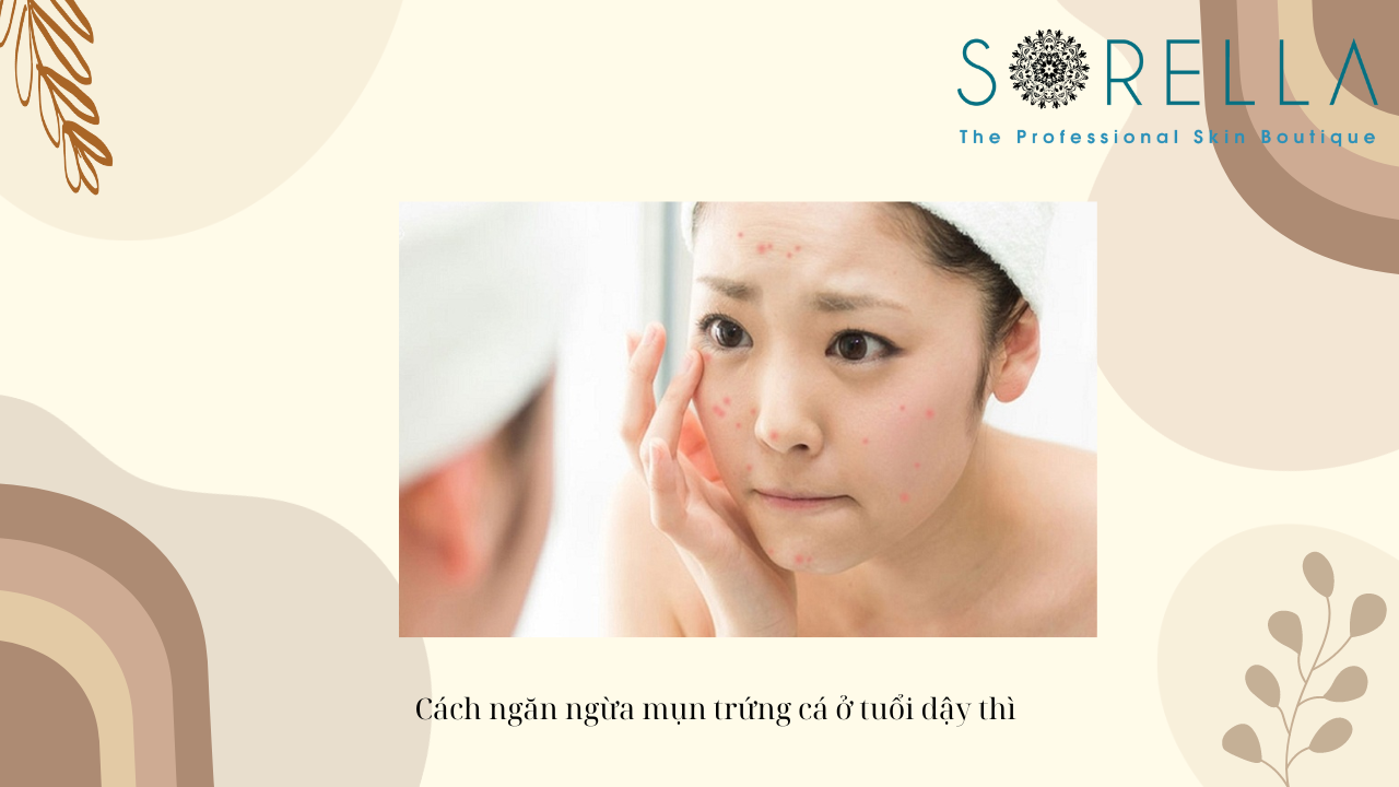 Mụn trứng cá ở tuổi dậy thì là gì?